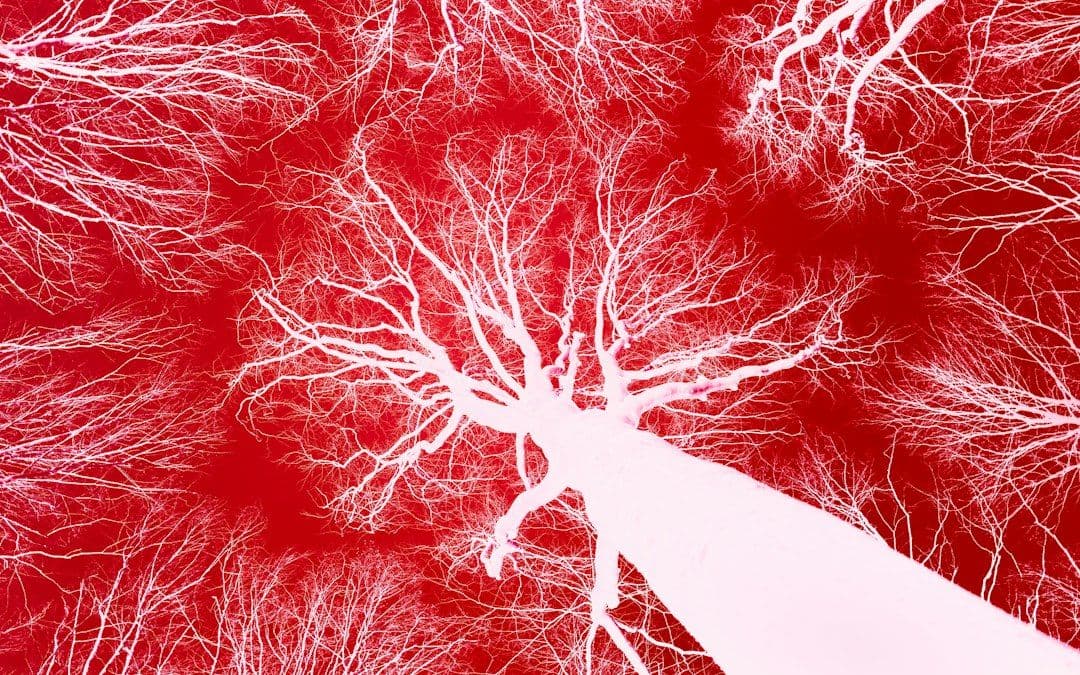 APOE4 może wiązać ryzyko Alzheimera ze zmianami wokół naczyń mózgu